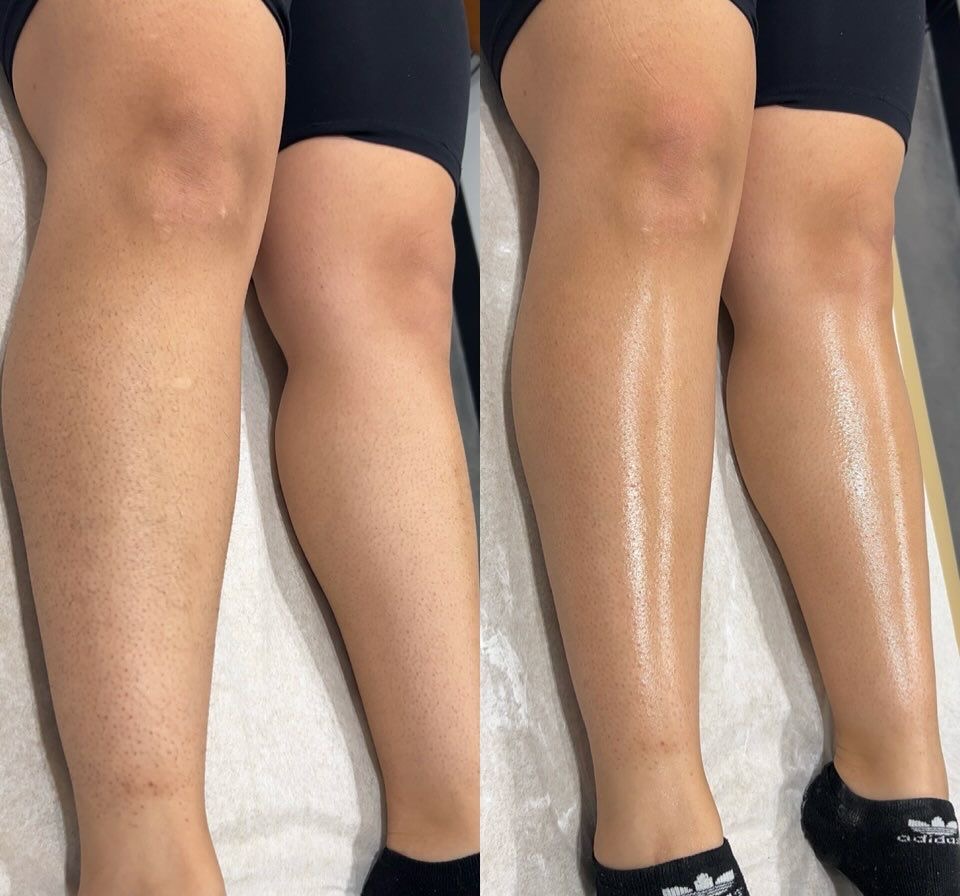 Depilación Media pierna 